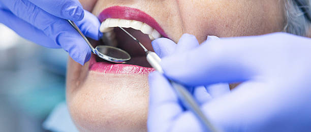 Best Emergency Treatment for Dental Infections or Abscesses in Glendora, CA